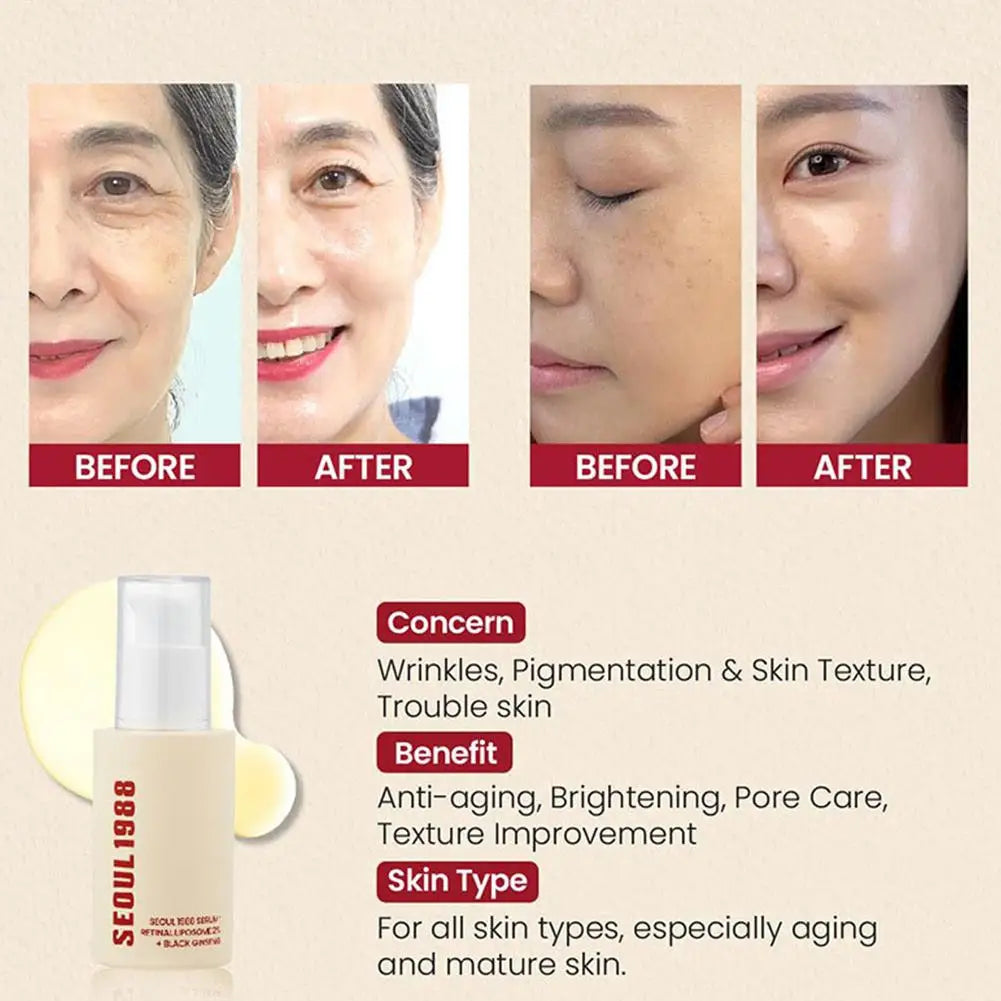 Korean Skincare Ginseng Facial Essence Seoul 1988 – Black Ginseng Extract Glow Face Serum with Retinol Liposome & Bakuchiol (30ml)