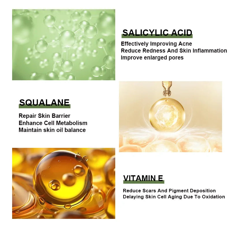 Anti-Acne Face Serum – Salicylic Acid Acne Removing Essence with Squalane & Vitamin E